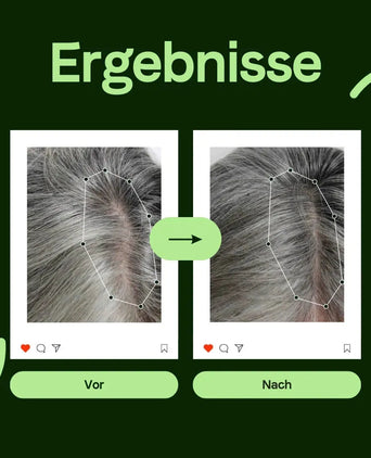 Scandinavian Biolabs Conditioner für Frauen (250 ml) - Hairgivers