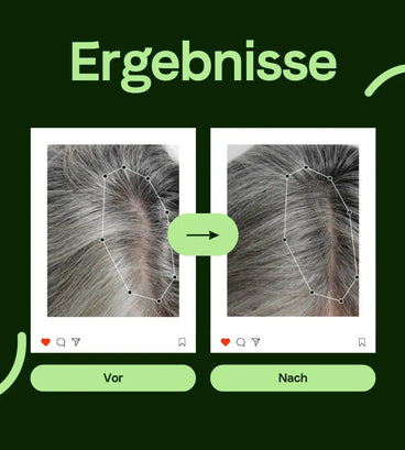 Scandinavian Biolabs Conditioner für Frauen (250 ml) - Hairgivers