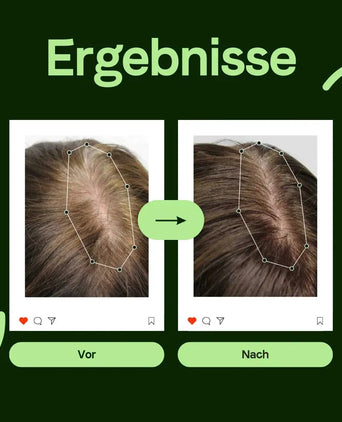 Scandinavian Biolabs Serum für Männer (100 ml) - Hairgivers