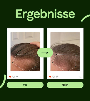 Scandinavian Biolabs Serum für Männer (100 ml) - Hairgivers