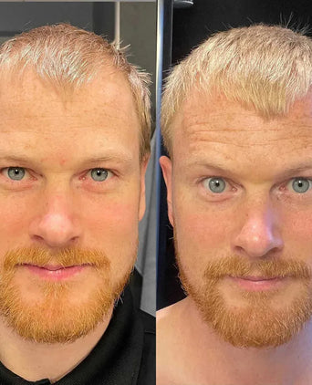 Scandinavian Biolabs Shampoo + Conditioner für Männer Kombi-Packung - Hairgivers
