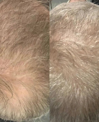 Scandinavian Biolabs Shampoo + Conditioner für Männer Kombi-Packung - Hairgivers