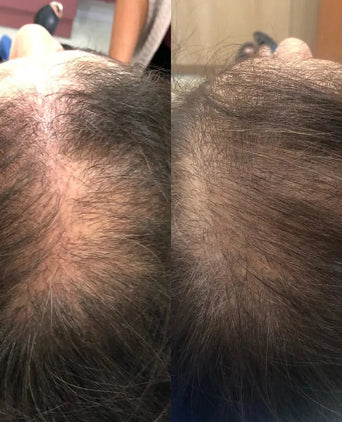 Spectral.CSF Haarserum - Hairgivers