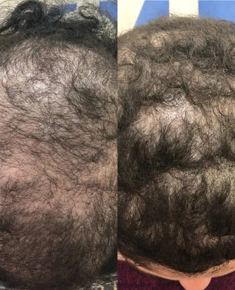 Spectral.CSF Haarserum - Hairgivers