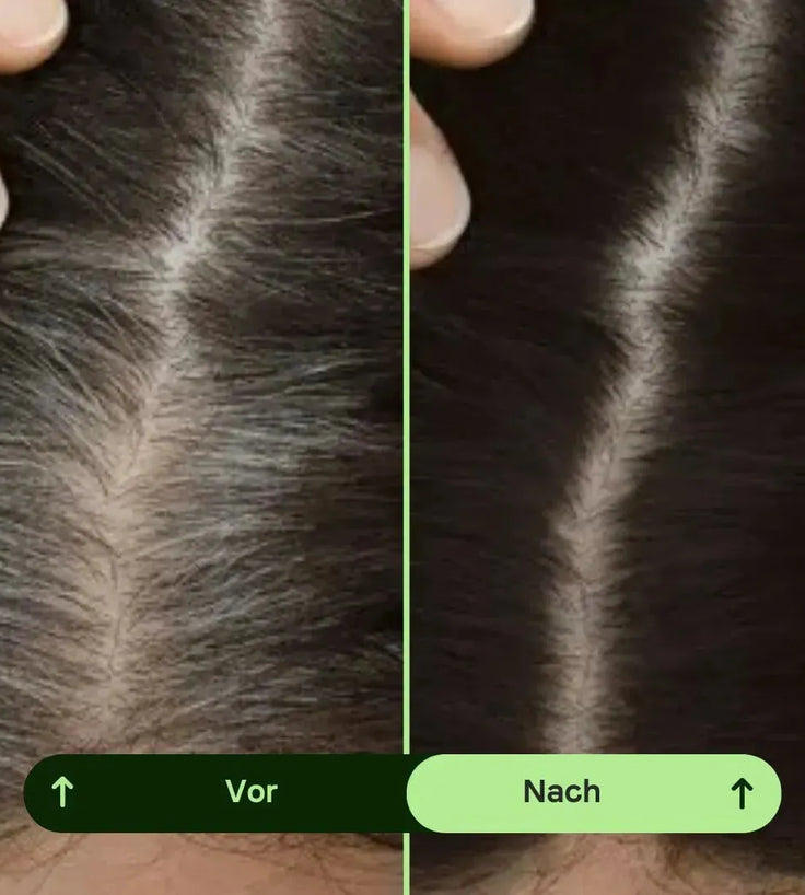 Toppik Hair Thickener Farbspray - Hairgivers