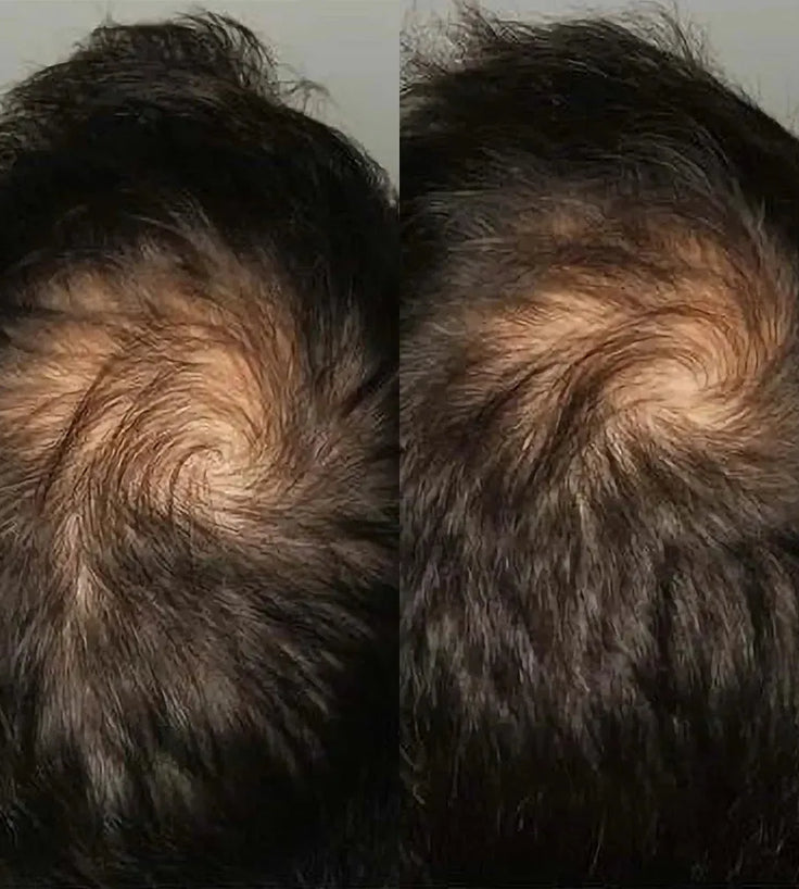 Viviscal Haarwachstum-Tabletten für Männer (1 Monat) - Hairgivers