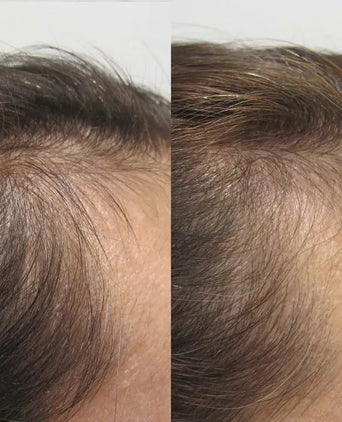 Viviscal Haarwachstums-Tabletten für Frauen (1 Monat) - Hairgivers