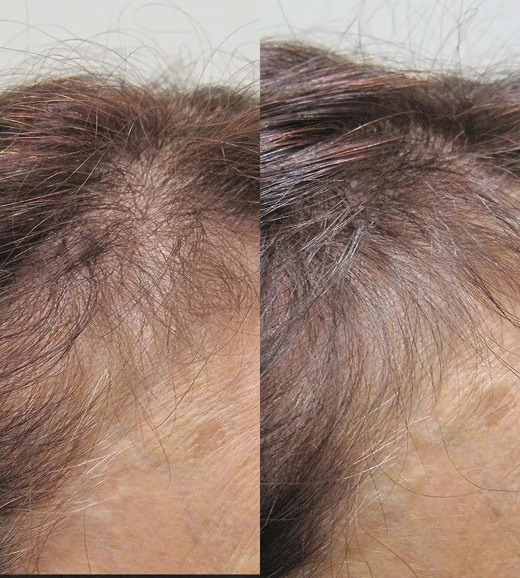 Viviscal Haarwachstums-Tabletten für Frauen (1 Monat) - Hairgivers