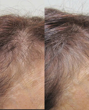 Viviscal Haarwachstums-Tabletten für Frauen (3 Monate) - Hairgivers