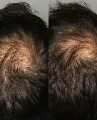 Viviscal Haarwachstums-Tabletten für Männer (3 Monate) - Hairgivers